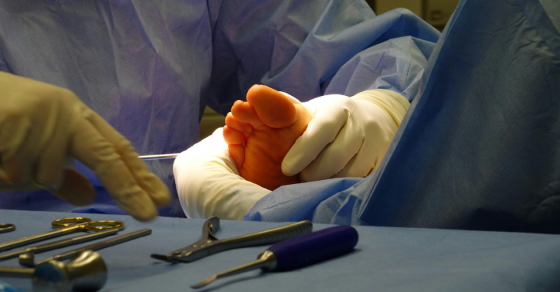Hallux valgus_02.png
