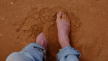 Hallux valgus_02.png.jpg