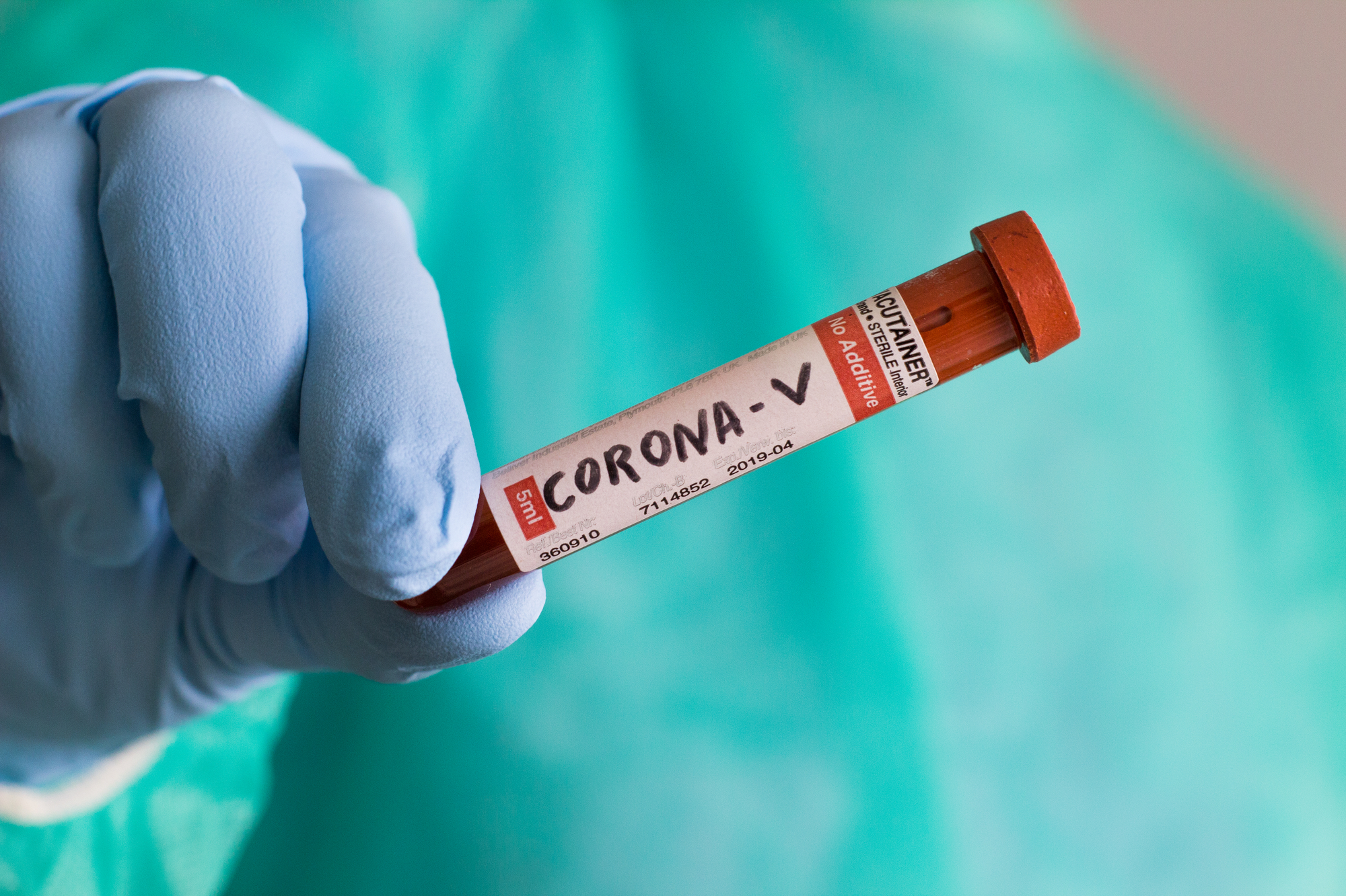 Chystáme se testovat na koronavirus, zájemci se mohou předem objednat online